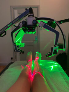 Fjärde laserbehandlingen 2