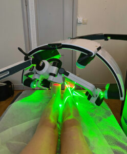 Laserbehandling 3